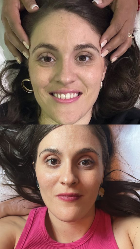 Antes y despues Facelift